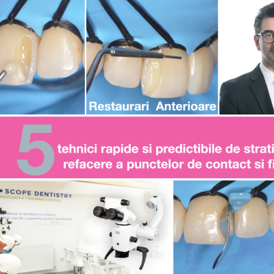 Restaurari anterioare - 5 tehnici rapide si predictibile de stratificare, refacere a punctelor de contact si finisare